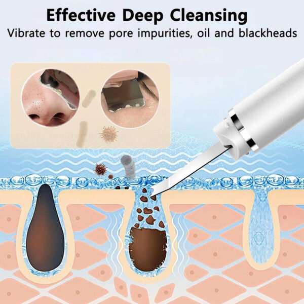 Ultrasonic Skin Scrubber Blackhead Remover
